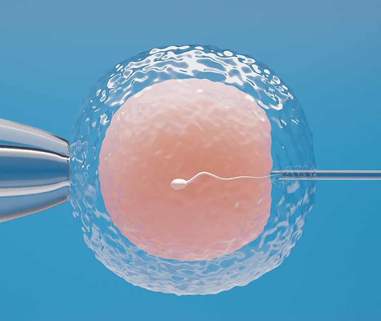 ivf