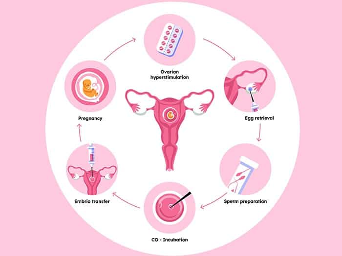 how ivf treatment works