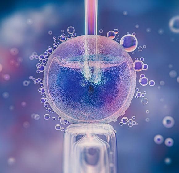 sperm retrieval procedure 02