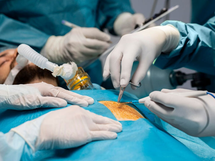 Laparoscopic Surgery 02