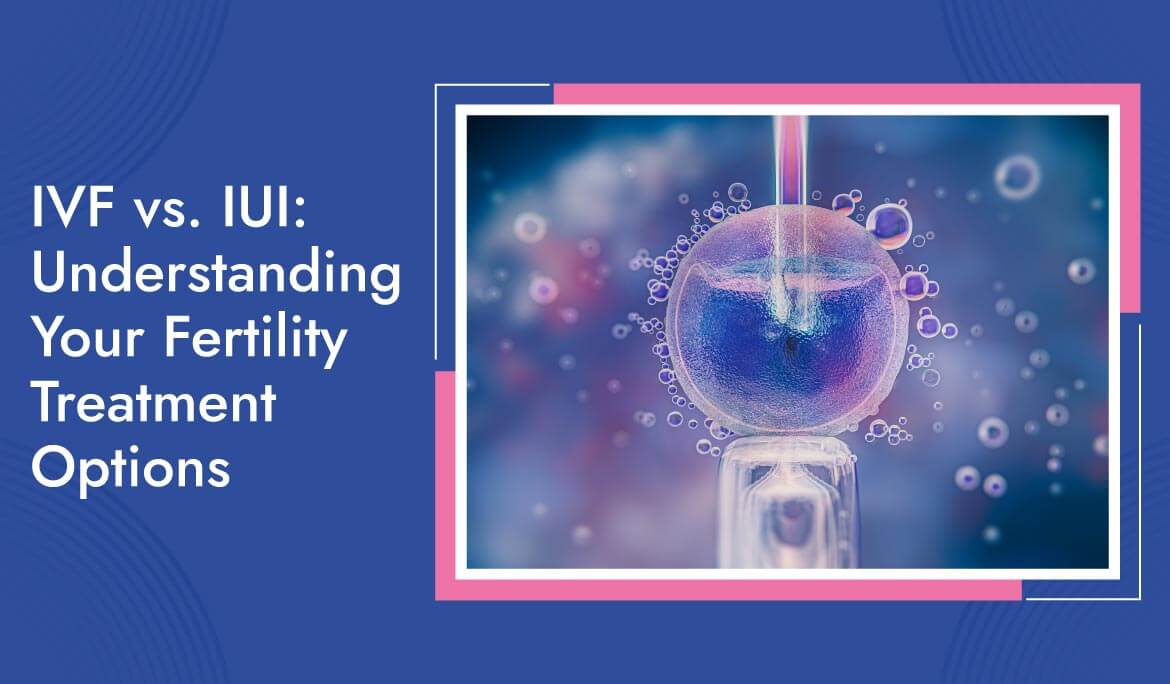 Ivf Vs. Iui Understanding Your Fertility Treatment Options